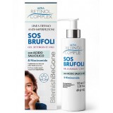Ultra Retinol Complex Sos Brufoli 100ml - Detergente Viso - Acido Salicilico